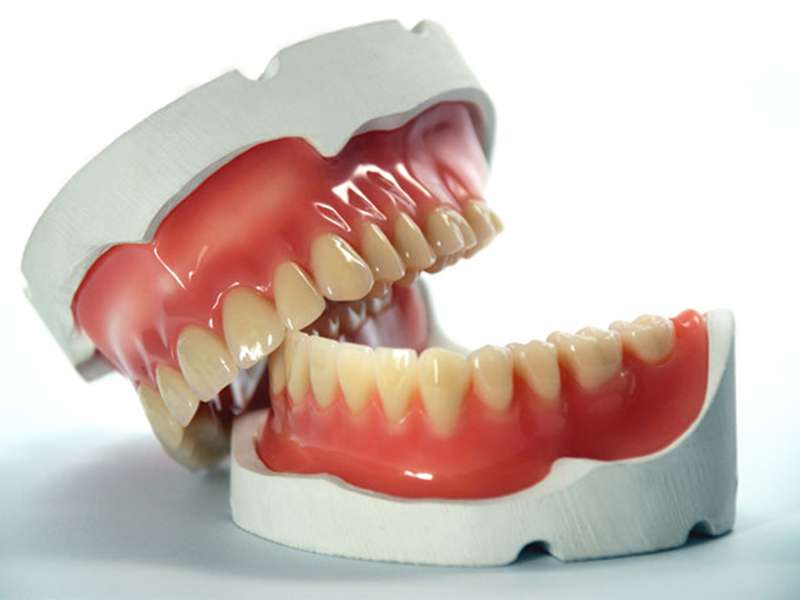 Protez Dişlerin Bakımı Nasıl Yapılmalıdır?