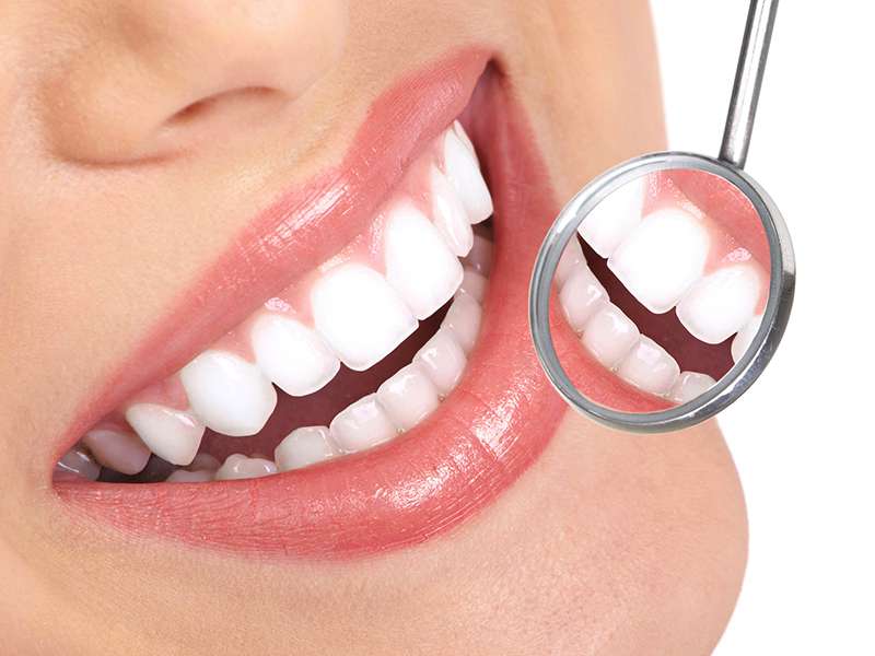 Protez Dişlerin Temizliğinde Nelere Dikkat Edilmelidir?